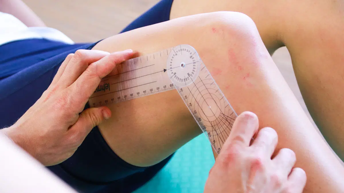Physiotherapeut misst die Beweglichkeit eines Kniegelenks mit einem Winkelmesser, um Bewegungseinschränkungen zu beurteilen.