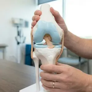 Anatomisches Modell des Kniegelenks zur Veranschaulichung von Kreuzbandriss und Meniskusschaden.