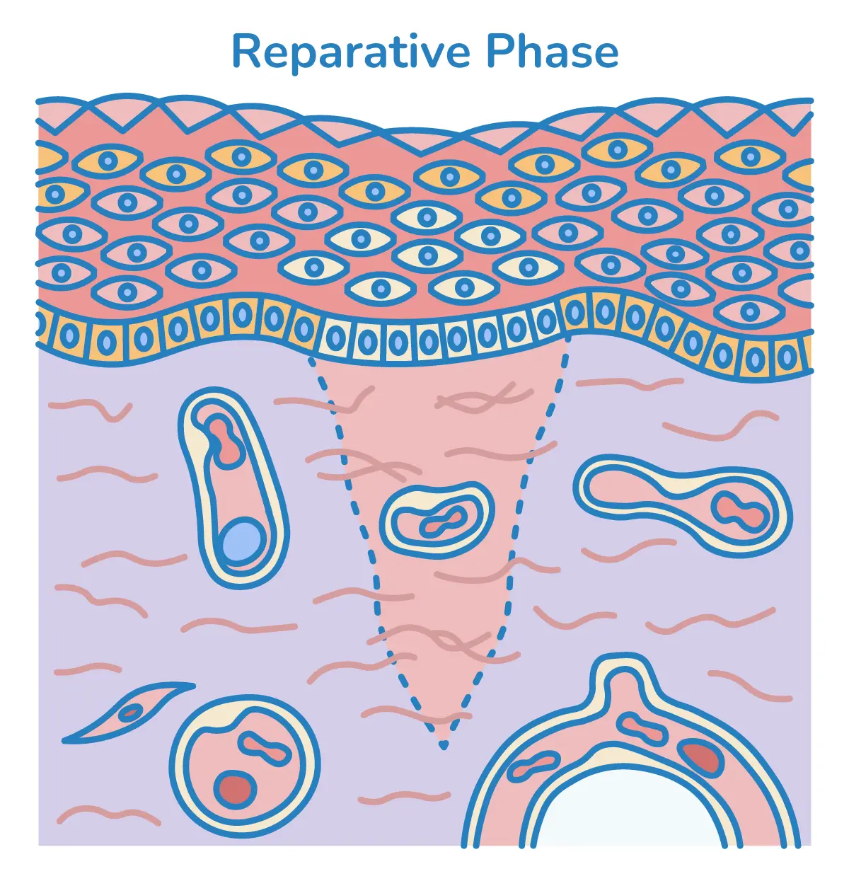 Illustration der Reparationsphase der Wundheilung.